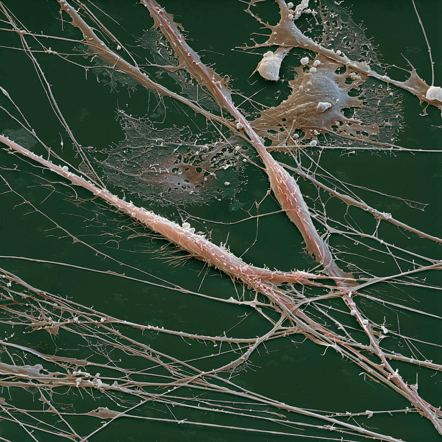 Spinal Ganglion Nerve Fibers Sem #2 Photograph by Meckes/ottawa