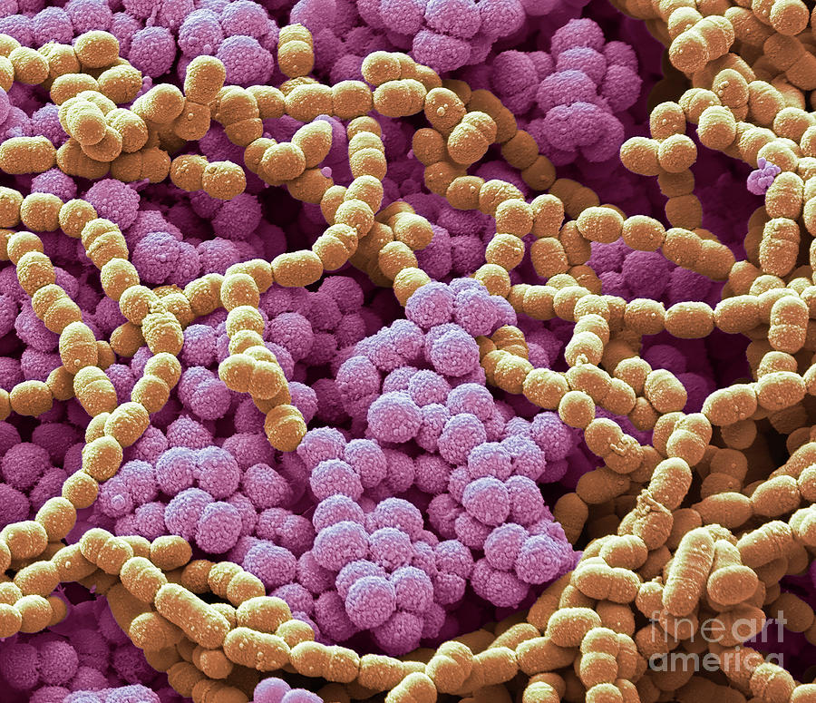 Sem Photograph - Sputum Culture #2 by Steve Gschmeissner/science Photo Library