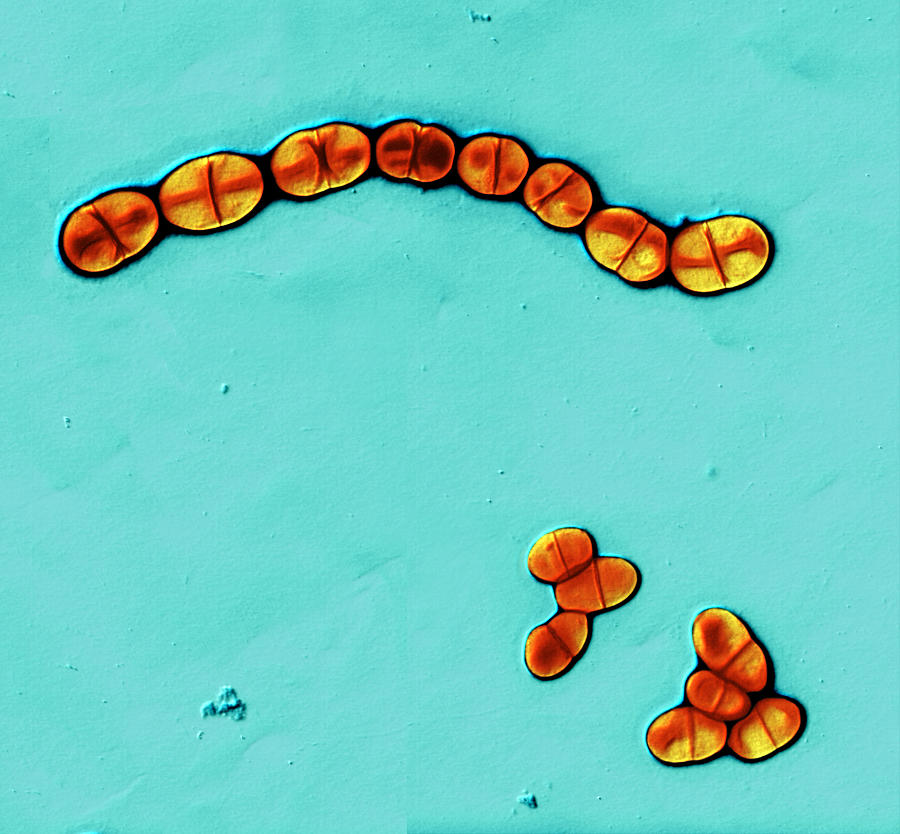 Streptococcus Mutans #2 Photograph by Meckes/ottawa