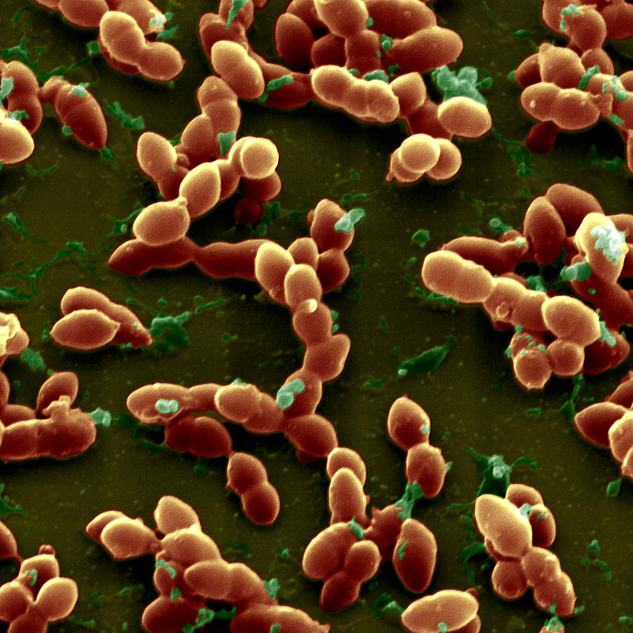 Streptococcus Pneumoniae #2 Photograph by Meckes/ottawa