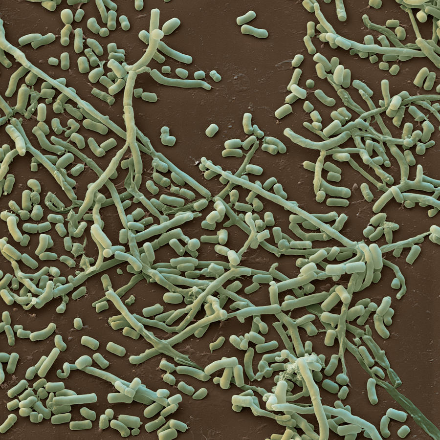Streptomyces Sp., Sem #2 Photograph by Meckes/ottawa