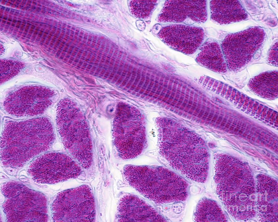 Striated Skeletal Muscle Fibres #2 Photograph by Jose Calvo/science Photo Library