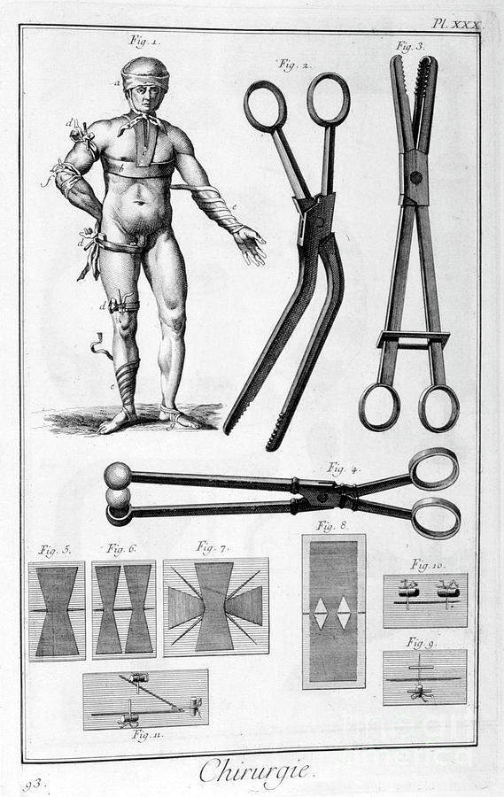 Surgery, 1751-1777 #2 Drawing by Print Collector