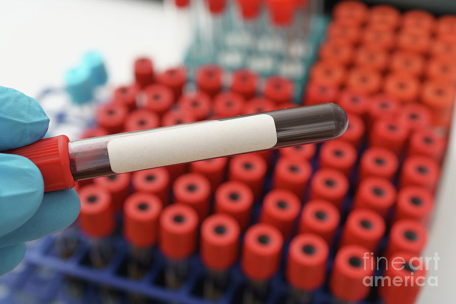 Test Tube With A Blood Sample Photograph By Wladimir Bulgar/science ...