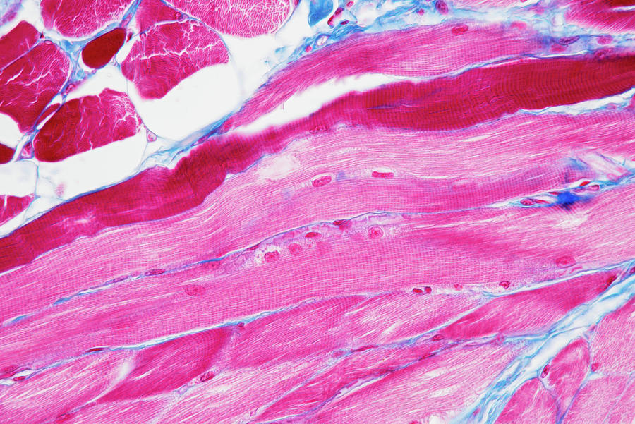 Tongue, Cross Section, Lm Photograph by Oliver Meckes EYE OF SCIENCE ...