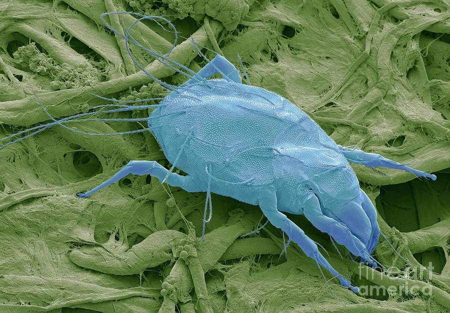 Animal Photograph - Water Mite #2 by Steve Gschmeissner/science Photo Library