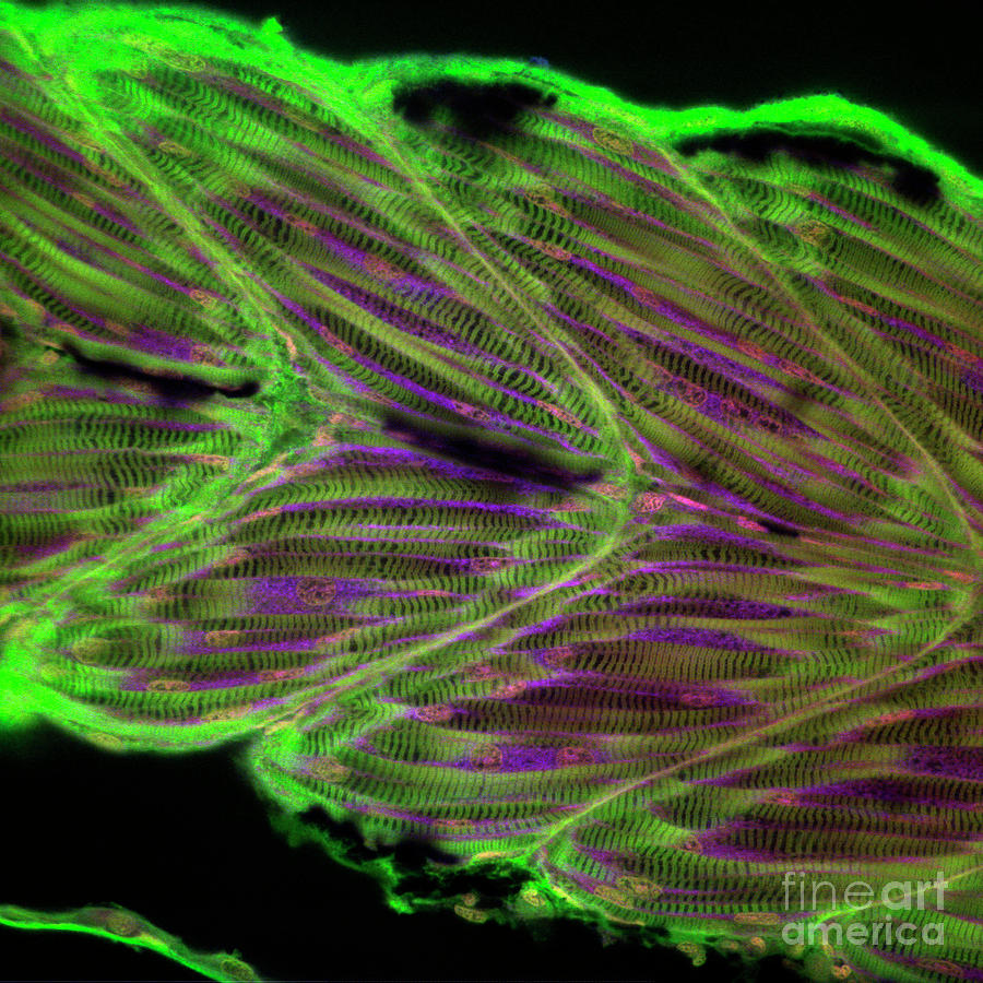Zebrafish Muscle #2 Photograph by Stefanie Reichelt/science Photo Library