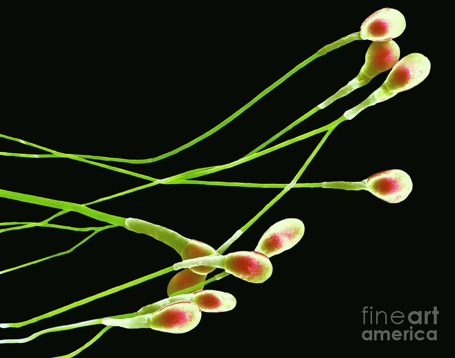 Biological Photograph - Human Sperm #20 by Dennis Kunkel Microscopy/science Photo Library