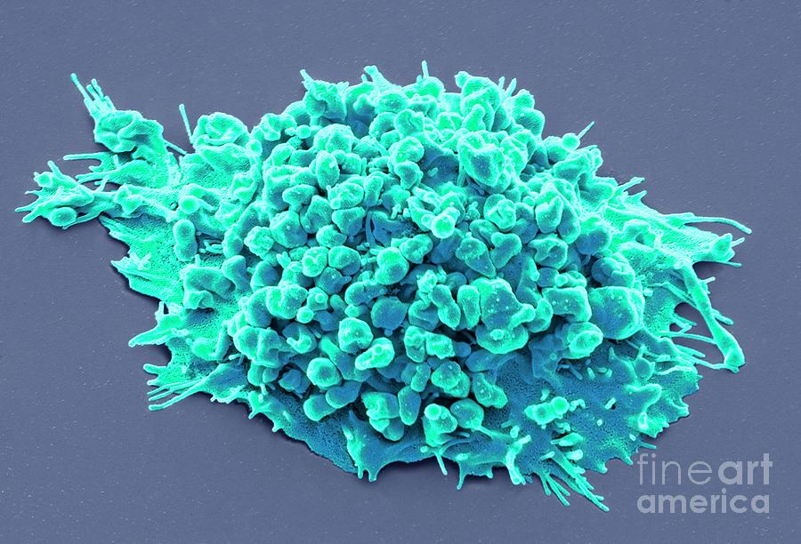 Lung Cancer Cell Photograph By Steve Gschmeissnerscience Photo Library Fine Art America 5229