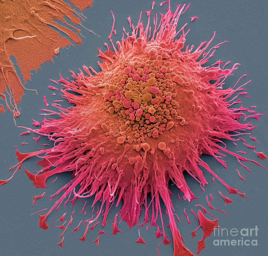 Macrophage Photograph by Steve Gschmeissner/science Photo Library | Pixels