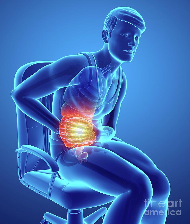 Man With Abdominal Pain Photograph By Pixologicstudio Science Photo