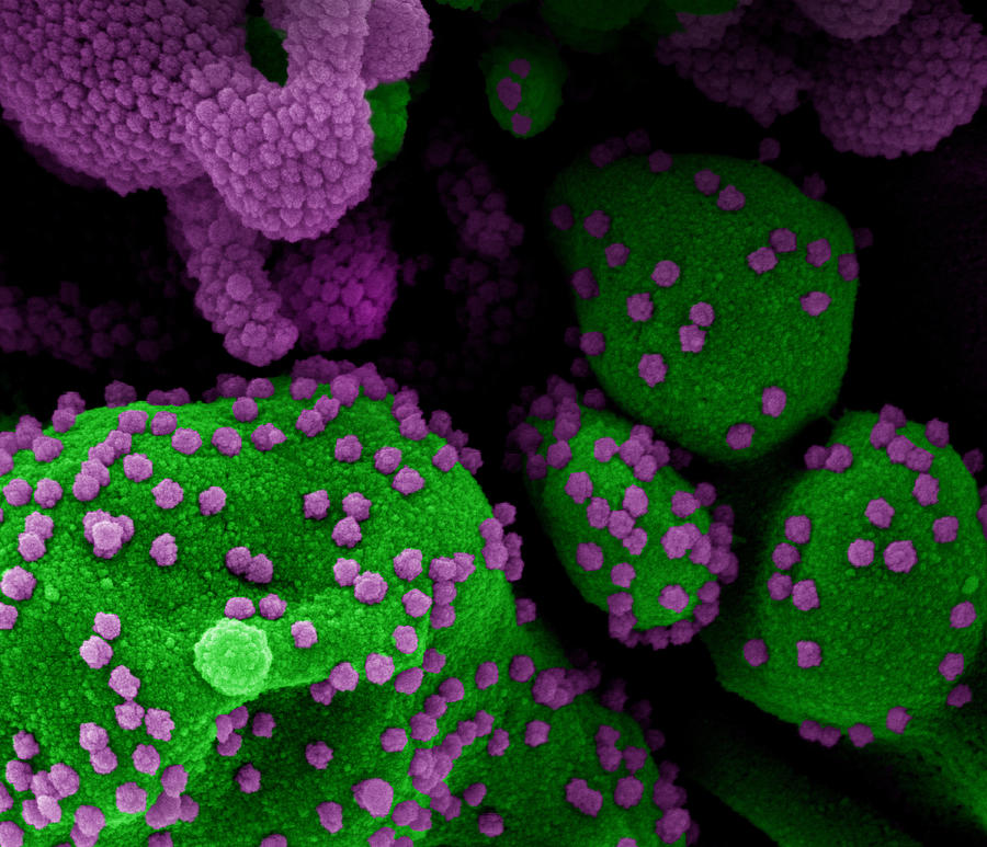 Sars-cov-2, Covid-19 Virus, Sem #21 Photograph by Science Source