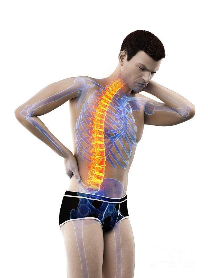 Skeleton Photograph - Back Pain #216 by Sebastian Kaulitzki/science Photo Library