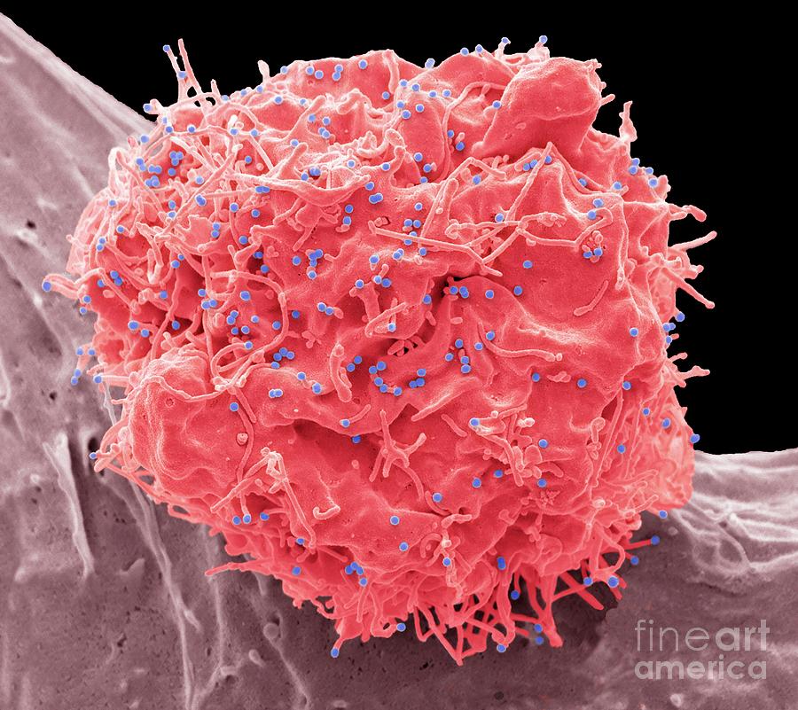 Hiv Infected Cell Photograph By Steve Gschmeissner Science Photo 