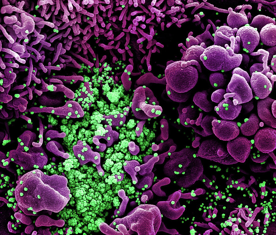 Sars-cov-2, Covid-19 Virus, Sem Photograph by Science Source - Fine Art ...