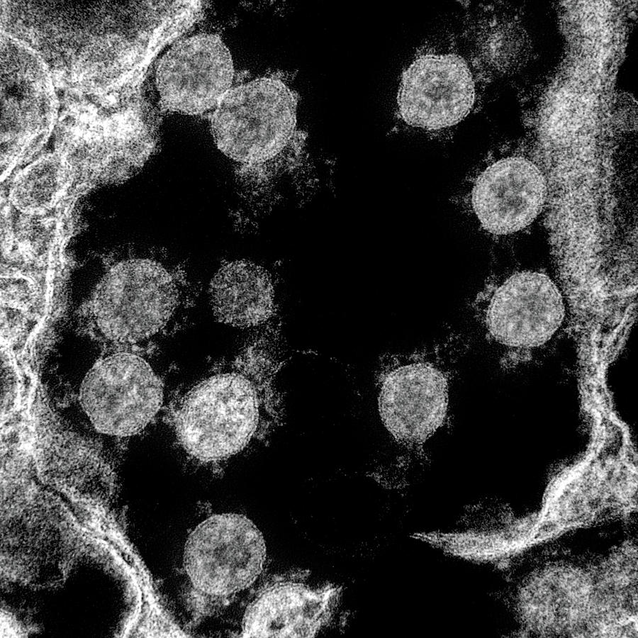 Sars-cov-2, Covid-19 Virus, Tem #22 Photograph by Science Source