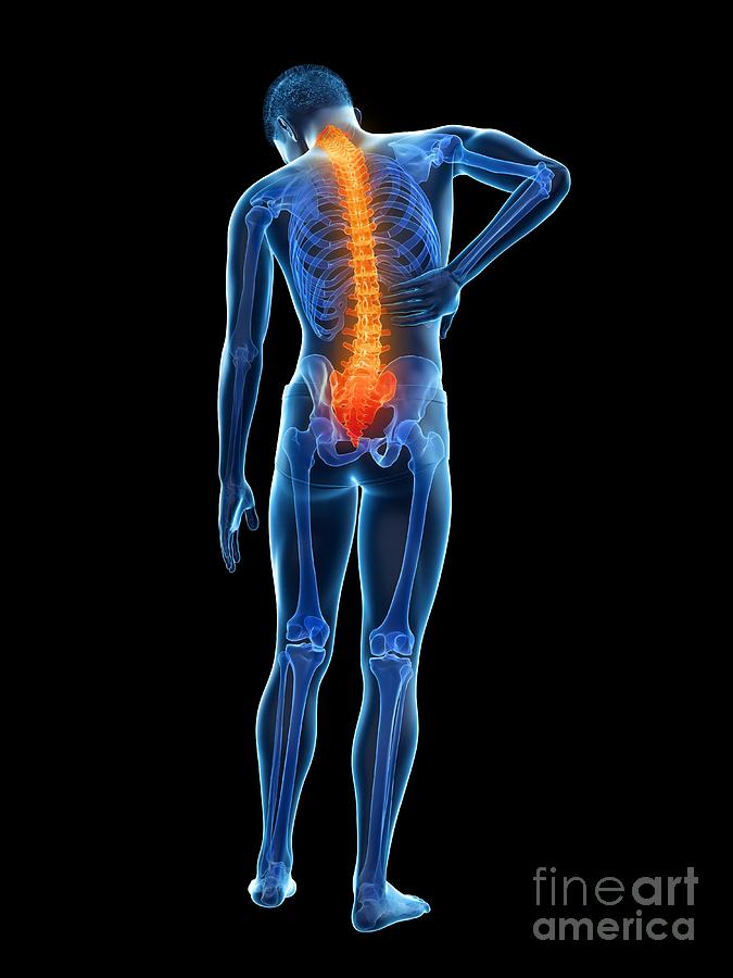 Skeleton Photograph - Back Pain #23 by Sebastian Kaulitzki/science Photo Library