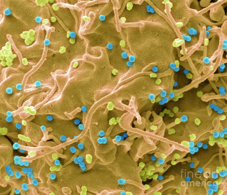 Hiv Infected Cell Photograph by Steve Gschmeissner/science Photo ...