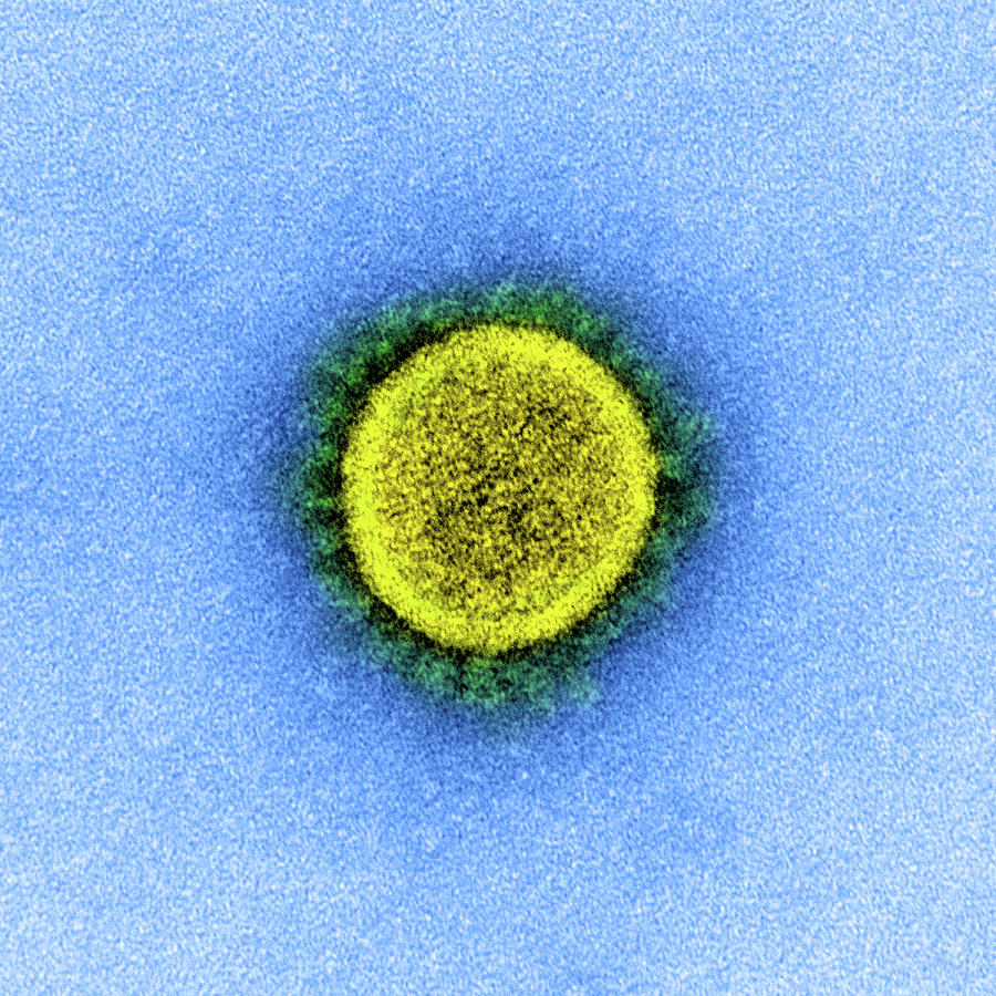 Sars-cov-2, Covid-19 Virus, Tem #23 Photograph by Science Source