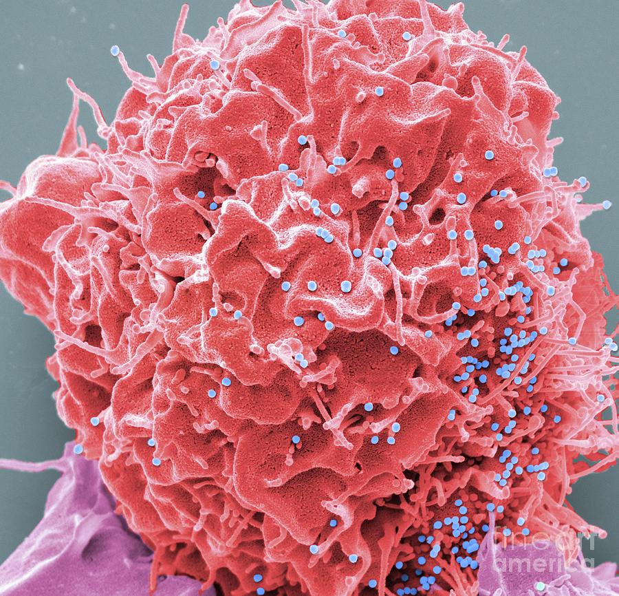 Hiv Infected Cell Photograph By Steve Gschmeissnerscience Photo