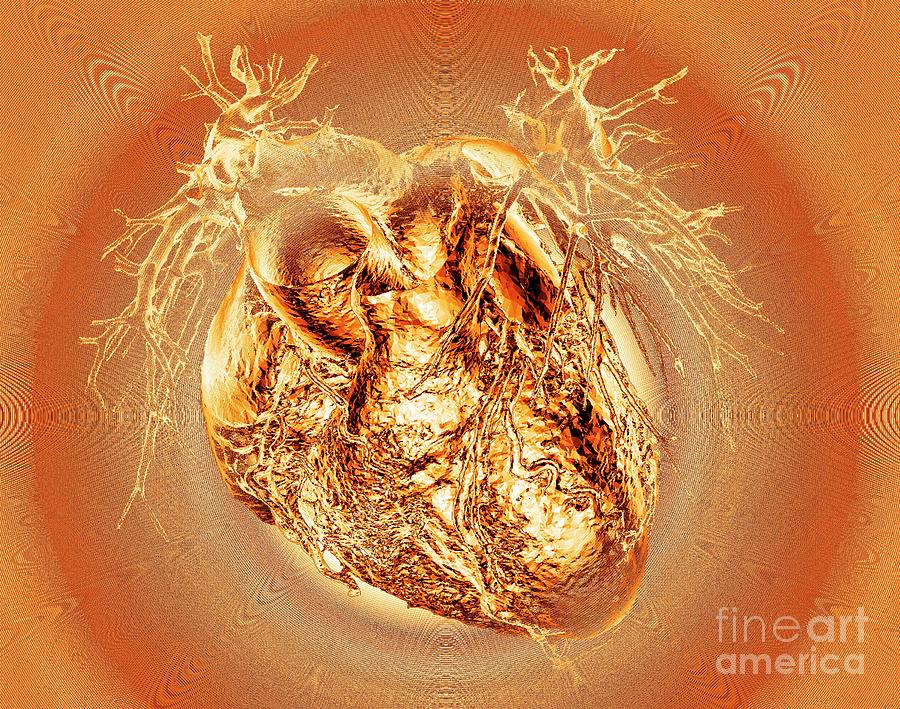 Heart Photograph - Human Heart #24 by K H Fung/science Photo Library