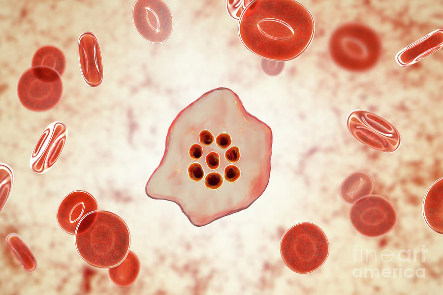 Plasmodium Ovale Inside Red Blood Cell #24 Photograph by Kateryna Kon/science Photo Library