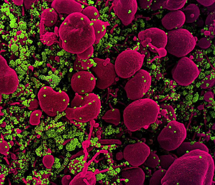Sars-cov-2, Covid-19 Virus, Sem #24 Photograph by Science Source