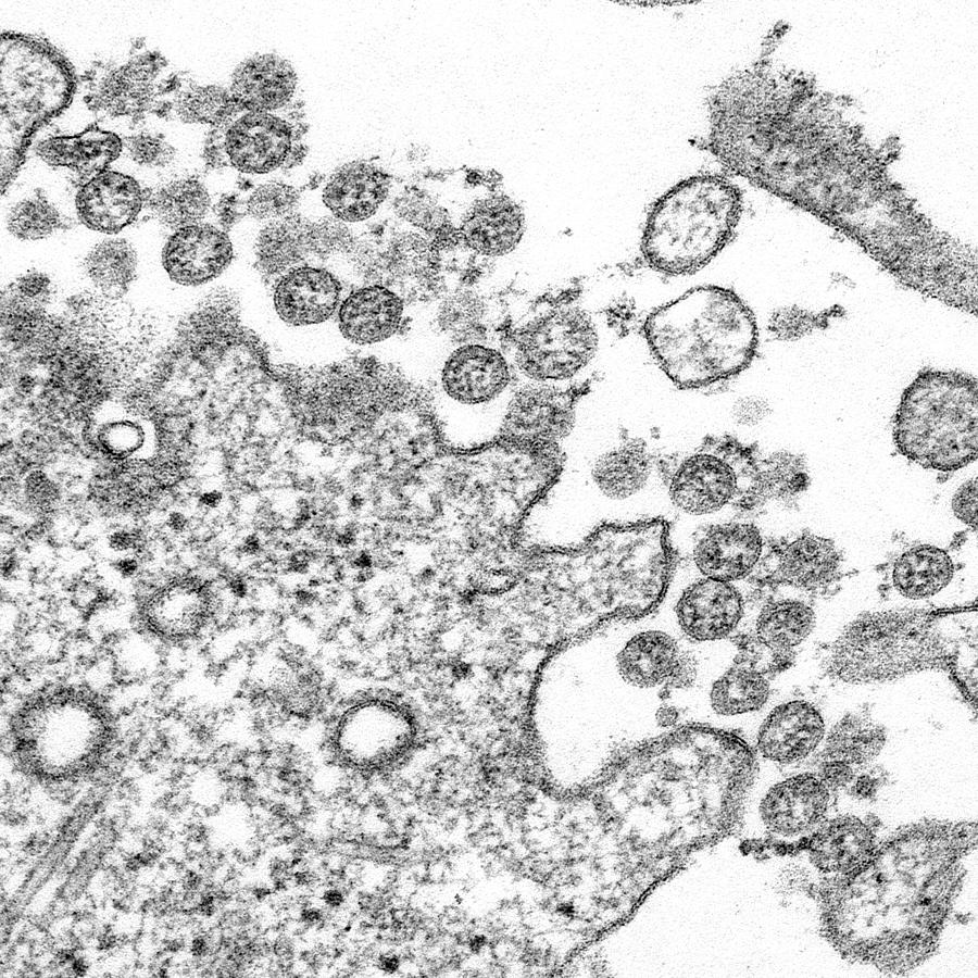 Sars-cov-2, Covid-19 Virus, Tem #24 Photograph by Science Source