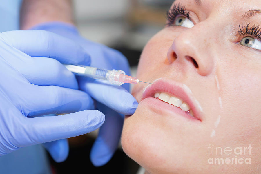 Woman Having Hyaluronic Acid Injections 24 By Microgen Imagesscience Photo Library 2069