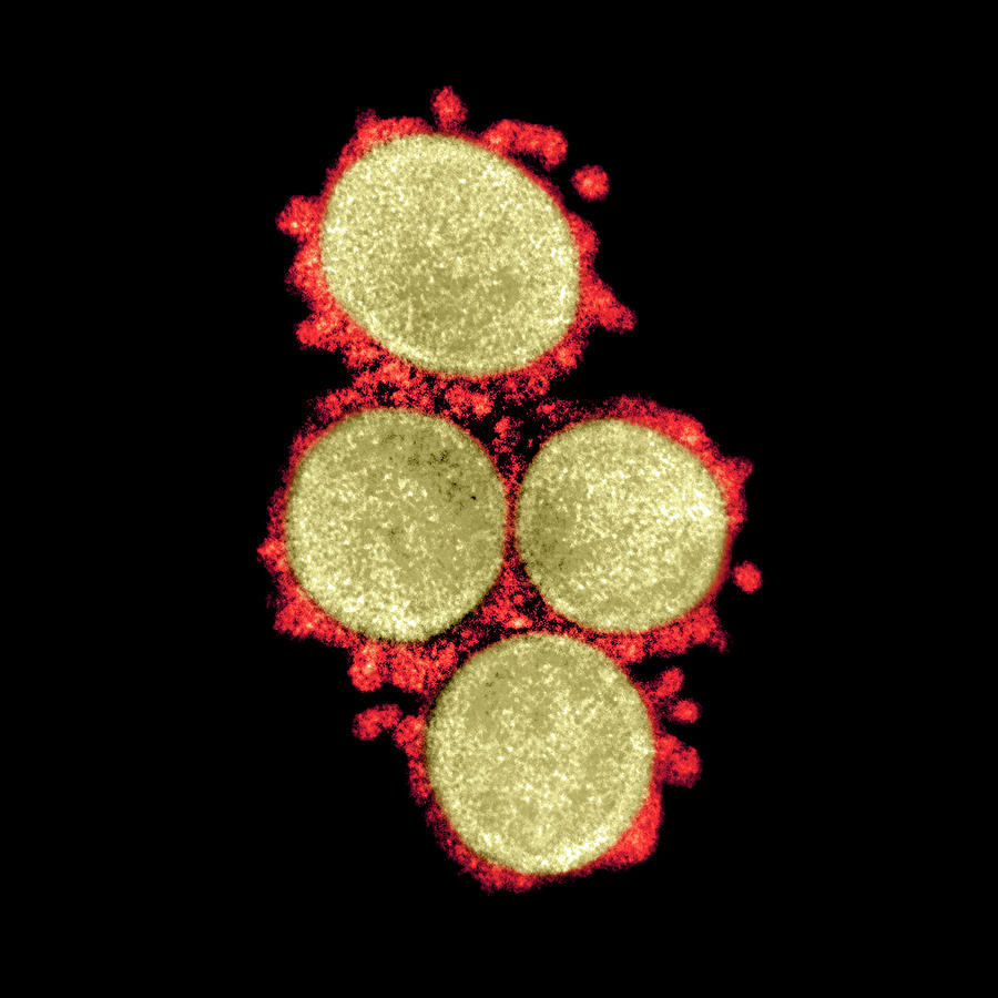 Sars-cov-2, Covid-19 Virus, Tem #25 Photograph by Science Source