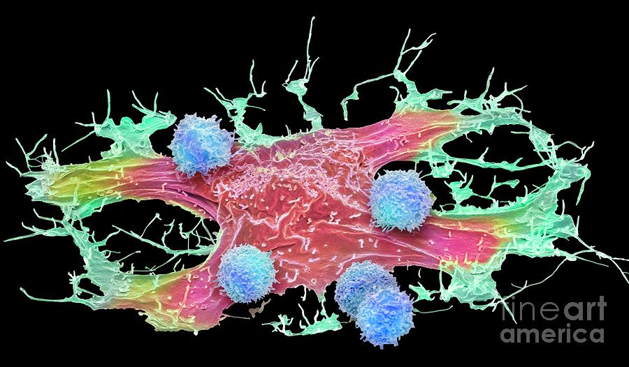 Car T-cell Therapy #26 Photograph by Steve Gschmeissner/science Photo Library