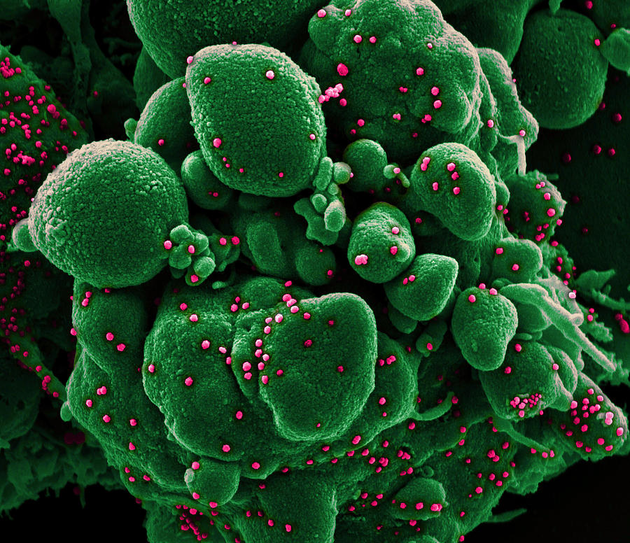 Sars-cov-2, Covid-19 Virus, Sem #26 Photograph by Science Source