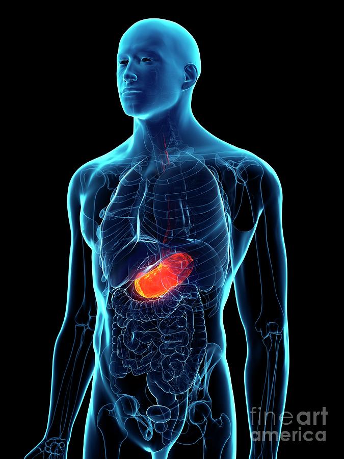 Diseased Stomach #27 Photograph by Sebastian Kaulitzki/science Photo Library