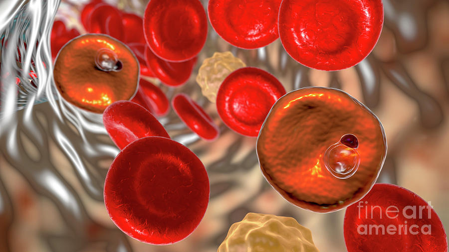 Plasmodium Vivax Inside Red Blood Cells #27 Photograph by Kateryna Kon/science Photo Library