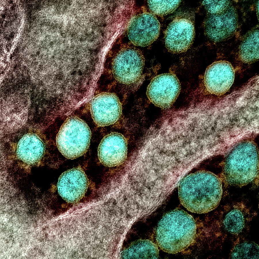 Sars-cov-2, Covid-19 Virus, Tem #27 Photograph by Science Source