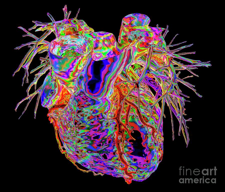Human Heart #28 Photograph by K H Fung/science Photo Library