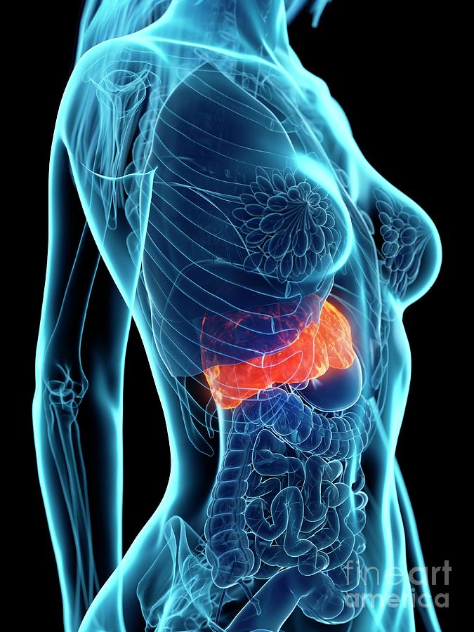 Diseased Liver #29 Photograph by Sebastian Kaulitzki/science Photo Library