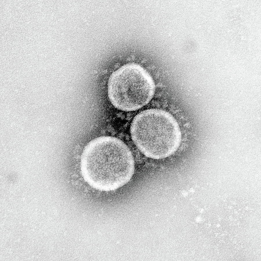 Sars-cov-2, Covid-19 Virus, Tem #29 Photograph by Science Source