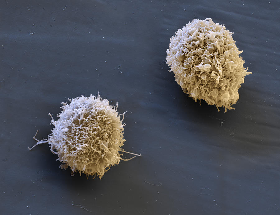 Activated Mast Cells, Sem #3 Photograph by Meckes/ottawa