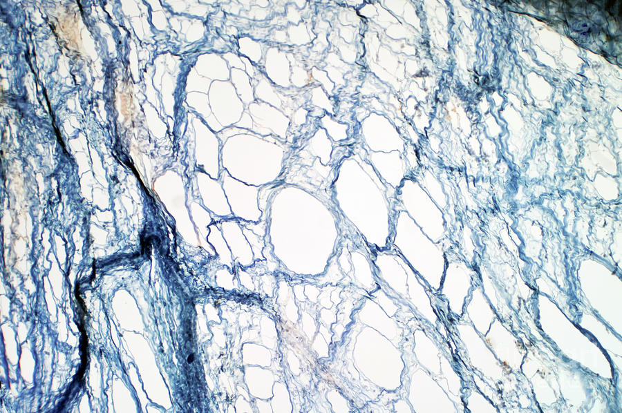Areolar Connective Tissue #3 Photograph by Choksawatdikorn / Science Photo Library