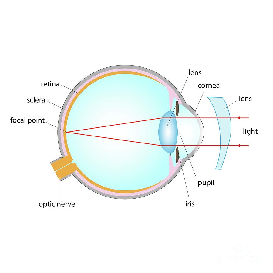 Astigmatism Corrected With A Lens Photograph by Cordelia Molloy/science ...