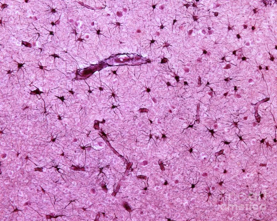 Astrocytes #3 Photograph by Jose Calvo / Science Photo Library