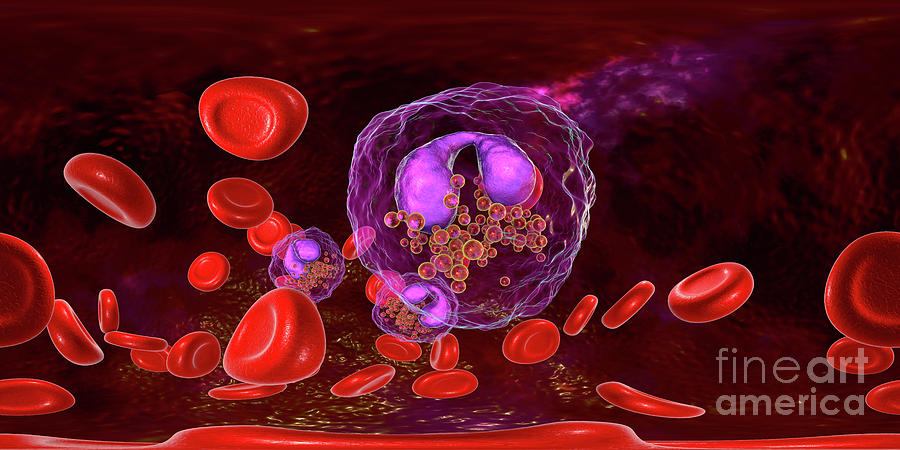 Blood Smear With Numerous Eosinophils Photograph by Kateryna Kon ...