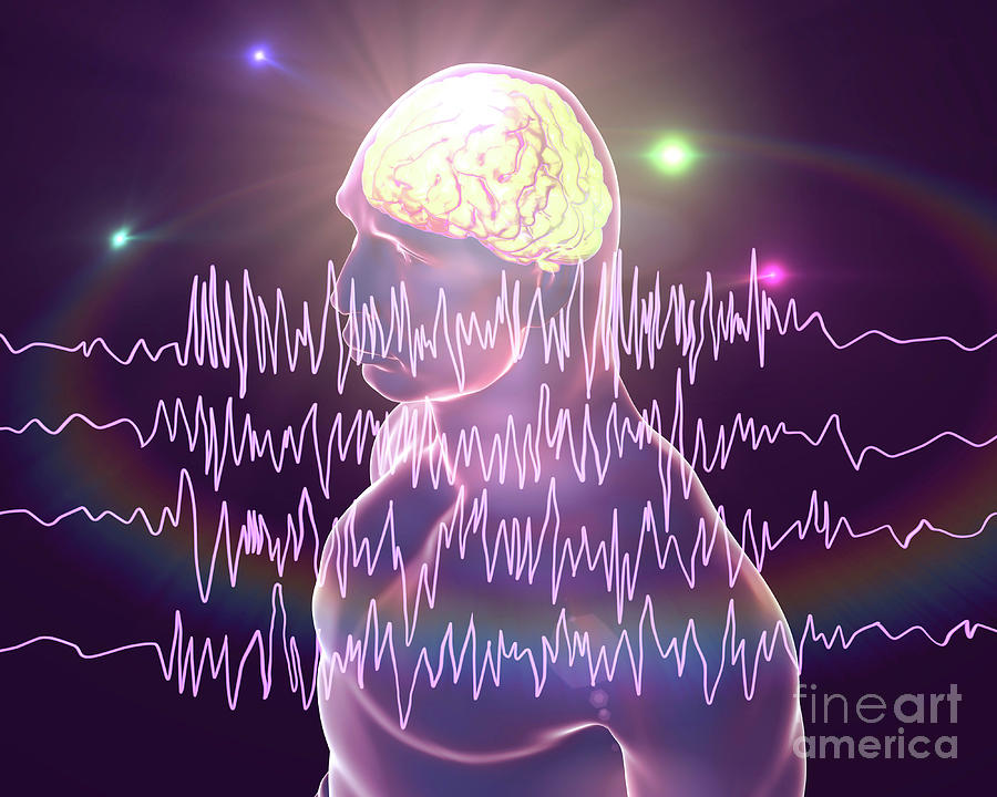 epilepsy brain waves