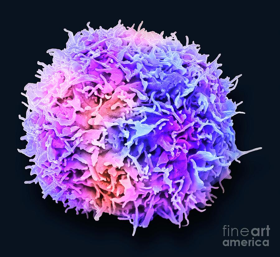 Brain Cancer Cell Photograph By Steve Gschmeissner Science Photo