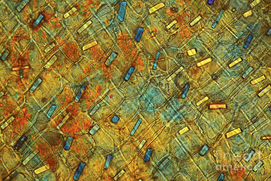 Calcium Oxalate Crystals In Onion Peel #3 Photograph by Marek Mis/science Photo Library