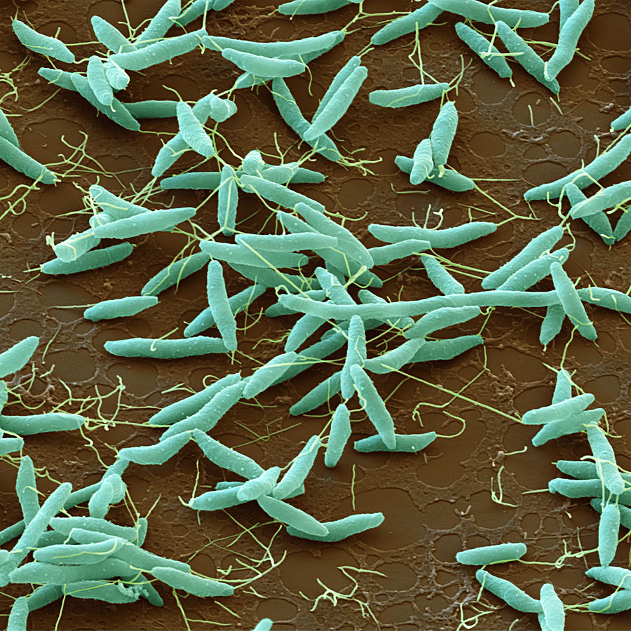 Campylobacter Jejuni, Sem #3 Photograph by Oliver Meckes EYE OF SCIENCE