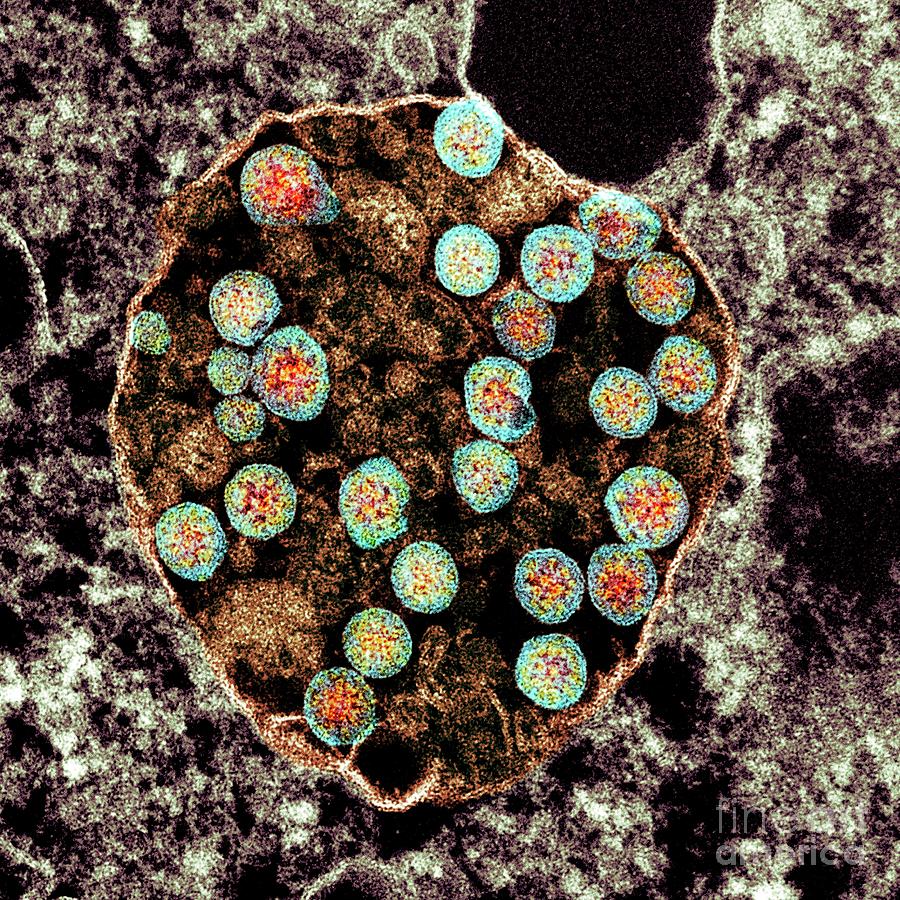 Cell Infected With Covid-19 Coronavirus Particles Photograph by Cynthia ...