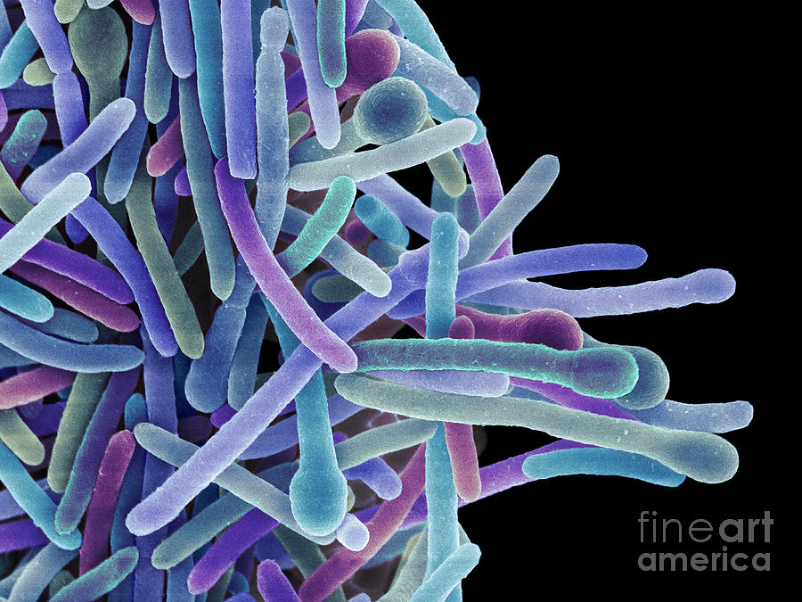 Clostridium Phytofermentans Bacteria #3 Photograph by Dennis Kunkel Microscopy/science Photo Library