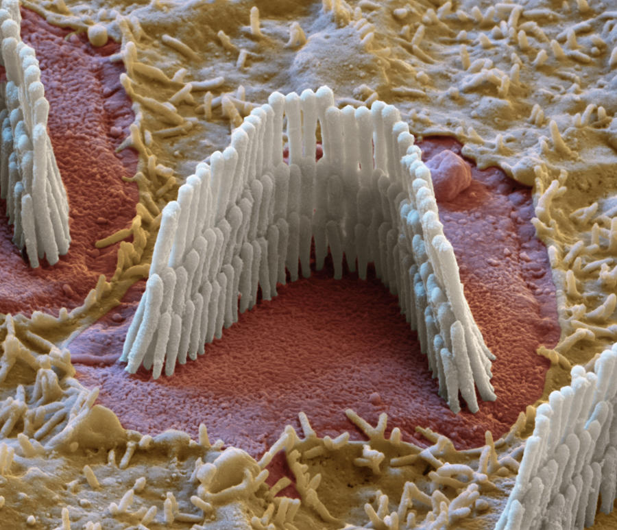 Cochlea, Outer Hair Cell, Sem #3 Photograph by Oliver Meckes EYE OF SCIENCE
